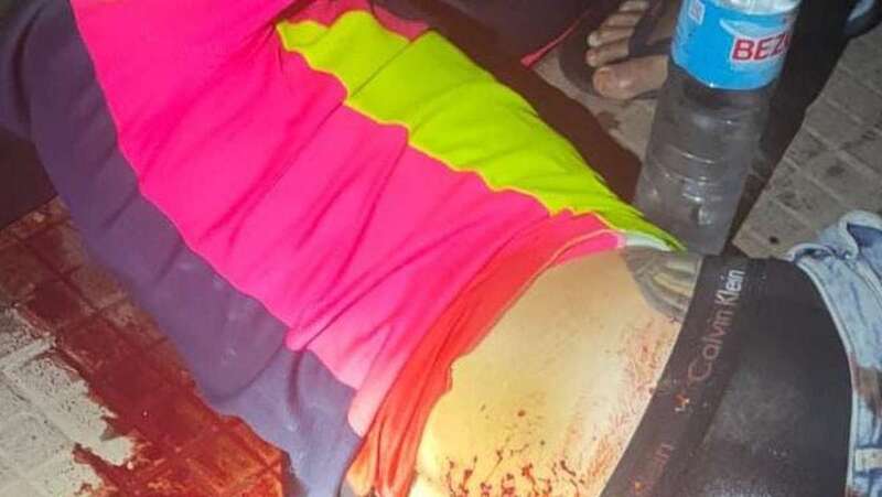 Uno de los heridos en el tiroteo/TA.